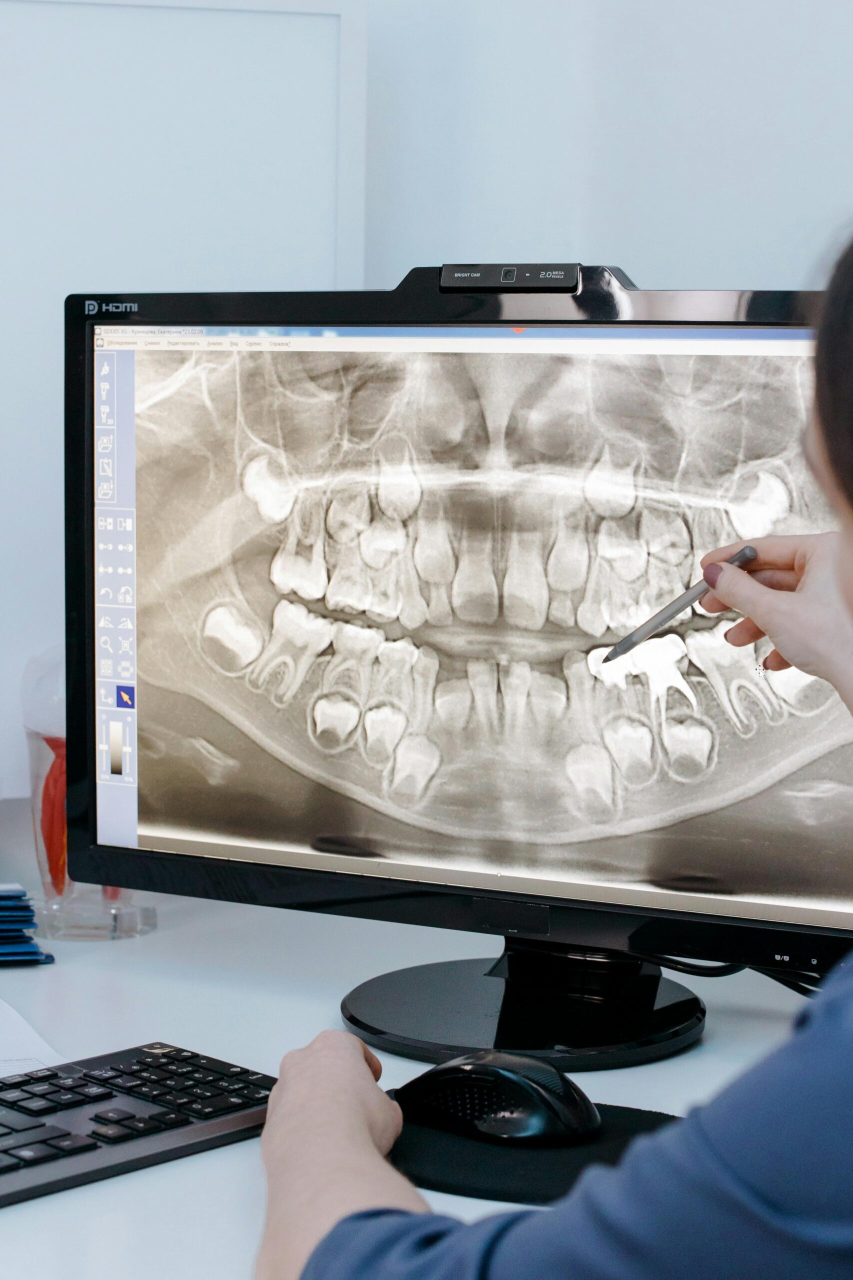 Close-up of a dentist analyzing a dental X-ray on a digital tablet in a clinic setting.